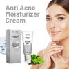 Eelhoe Hydrating Cream Hydrating And Lightening Facial Acne Redness Hydrating And Brightening Moisturizing Cream