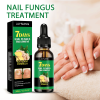 Jaysuing Ginger Nail Care Solution, Hand, Foot And Nail Care Soft Nail Shine Moisturizer Gray Nails