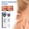 South Moon Warts r Cream, Skin Gram Wart Mole Meat Ball Wart Gentle Clean Smooth Skin