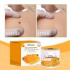 South Moon Bee Venom Wart Care Cream, Mole To Skin Tags Fade Spots Smooth Skin Wart Cream