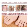 Jaysuing Nail Care Oil Soft Nail Brightening Nail Inlay Thickening Grey Nail Care Oil