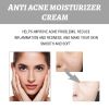 Eelhoe Hydrating Cream Hydrating And Lightening Facial Acne Redness Hydrating And Brightening Moisturizing Cream