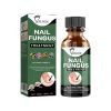 EELHOE Nail Care Solution For Nail Surface Thick Nails Soft Nails Gentle Cleansing And Moisturizing Solution