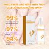 OUHOE Foot es Moisturizing Spray, Heel es, Dead Skin, Moisturize And Moisturize Foot Care