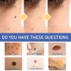 South Moon Warts r Cream, Skin Gram Wart Mole Meat Ball Wart Gentle Clean Smooth Skin