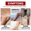 EELHOE Leg Care Cream Leg Massage Comfort Care Gentle Ingredients Nourishing Care Leg Care Cream