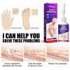 South Moon Chicken Eye Lotion Extra Clear s Skin Care Chicken es Foot Pad Gram Warts